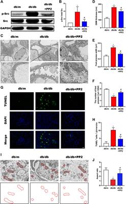 Src Activation Aggravates Podocyte Injury in Diabetic Nephropathy via Suppression of FUNDC1-Mediated Mitophagy